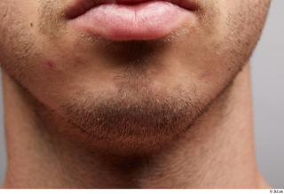 HD face Skin Joel chin face lips mouth skin pores…